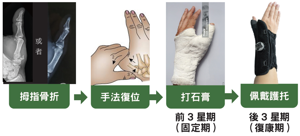 Saddle joint conservative treatment 2